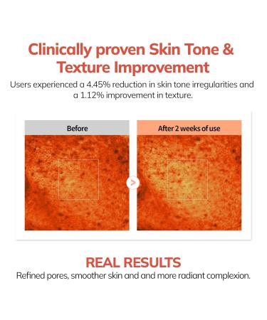 Buy MERZY W-Tomato Niacinamide 10% Serum 1.69fl.oz - Brightening & Hydrating - International Shipping Available - Buy Online on GoSupps.com