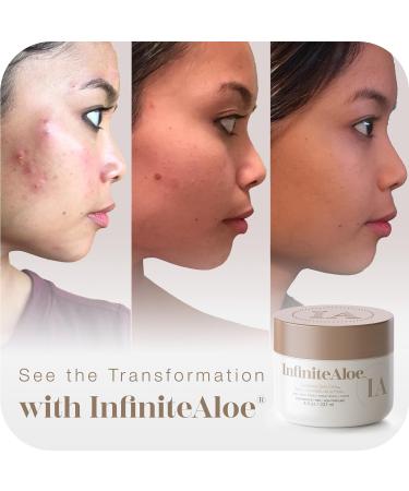 Infinite Aloe Skin Care Cream 237 ml - Perfume-Free International Shipping Available - Buy Online on GoSupps.com