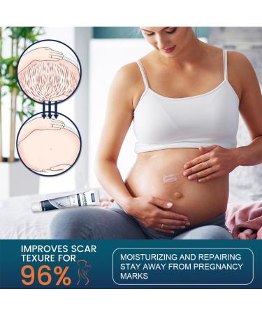 RedOceansM Scar gel scar removal cream scar care gel scar repair cream stretch mark creams remover 20 g scar ointment after use natural scar gel reduces the visibility of - Buy Online on GoSupps.com