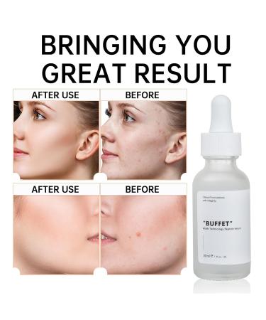 Buffet Peptides Serum for Face - 30ML Anti-Aging Multi Peptide Serum | Moisturizing Solution for Fine Lines & Acne - Shop Now - Buy Online on GoSupps.com