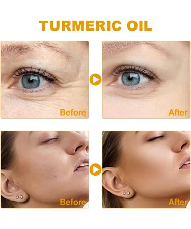 Turmeric Dark Spot Corrector Serum Turmeric Repair face care Face Serum Bright Skin Moisturizing Repair Whitening Serum for Face 2022 New Organic Skin Lightener (1PC) - Buy Online on GoSupps.com