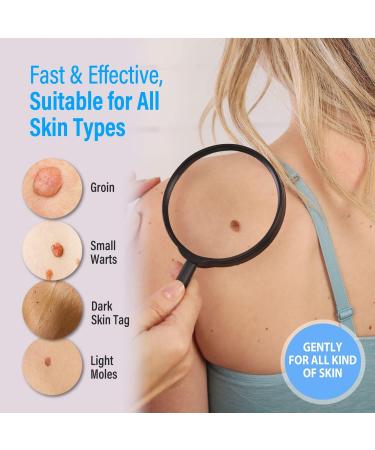 Zacurate Skin Tag Remover & Wart Mole Verruca Treatment Lotion - Fast-Acting Blue Formula - 30ML (Pack of 1) - Buy Online on GoSupps.com