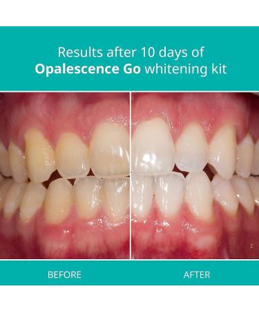 Opalescence Go 15% Teeth Whitening Trays - Boxed 10 Pack - Mint Flavor - Buy Online on GoSupps.com