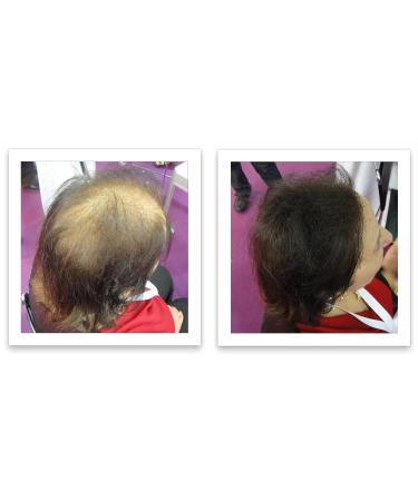 Caboki Hair Building Fiber 16G Dark Brown - Instantly Thicker Hair Solution - Buy Online on GoSupps.com