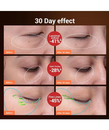 TOUCHBeauty Heated Eye Massager | 40 Sonic High Frequency Vibration | Anti-Aging Galvanic Wand | USB Rechargeable | Dark Circles & Puffiness Relief | AG-1662 - Buy Online on GoSupps.com