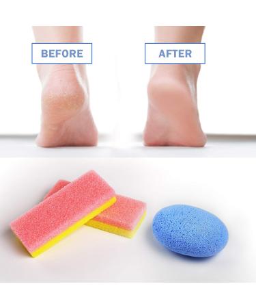 Pedicure Foot Pumice Stone Set for Heavy Callused Feet - 2 Glass Stones & 2 Scrubber Sponges for Dead Skin Removal - Buy Online on GoSupps.com