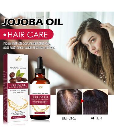 Regrow Hair Oil - Scalp Oil Hair Growth Jojoba Oil Anti-frizz Hair Density Oil For Hair Growth | Natural Hair Regrowth Oil With Wild Hair Growth Oil 30ml For Women & Men - Buy Online on GoSupps.com