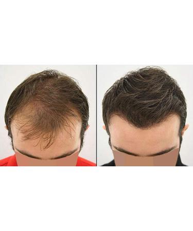 Natural Keratin Hair Fibre Refill for Hair Loss - 25g Grey (Pack of 1) | For Alopecia & Chemotherapy - Buy Online on GoSupps.com