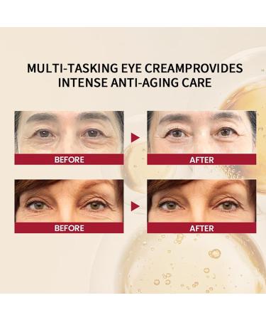 1988EyeCream Antiaging eye cream with 4 retinal liposome antiwrinkle eye cream against wrinkles and circles around the eyes smoothing bags and dark circles around the eyes - Buy Online on GoSupps.com