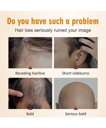 Hair Growth Serum with Tumeric for Women & Men - 2oz | Strengthens, Thickens, and Nourishes Hair | Fast Results for Split Ends & Dry Scalp - Buy Online on GoSupps.com