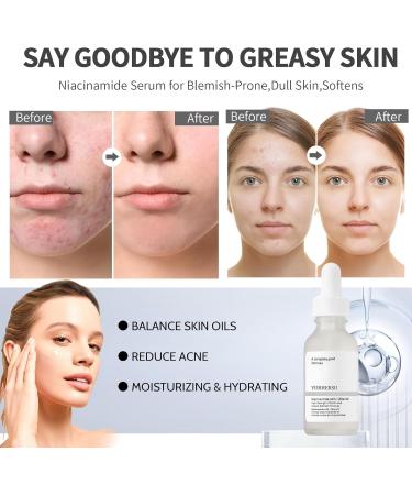 Face moisturizer Niacinamide10%+Zinc 1% Pore Reducer Face Serum Niacinamide Serum for Blemish-Prone High-Strength Vitamin to Control Excess Oil and Redness Tackles Blemishes Dull Skin - Buy Online on GoSupps.com