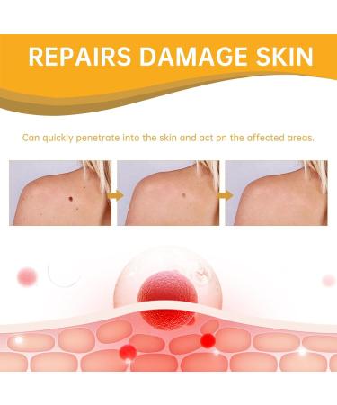 20 ml Beeergift Treatment Spray - Remove Skin Spots & Warts on Arms Waist Feet & Legs - Fast Acting Beeergift Solution - Buy Online on GoSupps.com