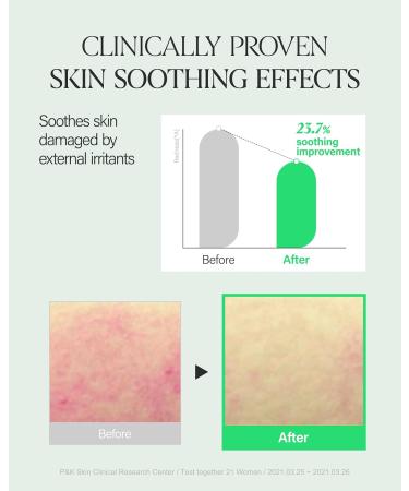 About Me SOOP Calming Aqua Serum - 53.4% Jeju Cypress Water Gel Serum with Bursting Capsules Hydrating Face Serum for Sensitive Skin Centella Cica & Tea Tree Vegan Non-Sticky 1.69 oz (50ml) - Buy Online on GoSupps.com