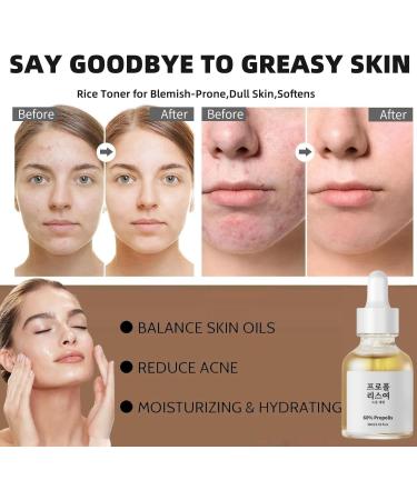 Face Glow Serum with Propolis and Niacinamide Face Serum for Women Korean Skincare Serum Moisturiser Face Hydrating Serum Plump and Smooth Brightening Serum Anti Aging Serum for Face Fade Fine Lines - Buy Online on GoSupps.com