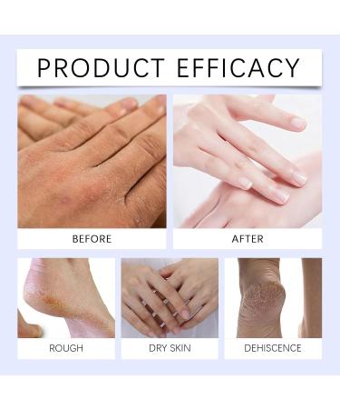 Travel Size Lotion Moisturizing Hand Cream | Hand Softener for Caregivers Gardeners Hiking Cracked Skin Care - Buy Online on GoSupps.com