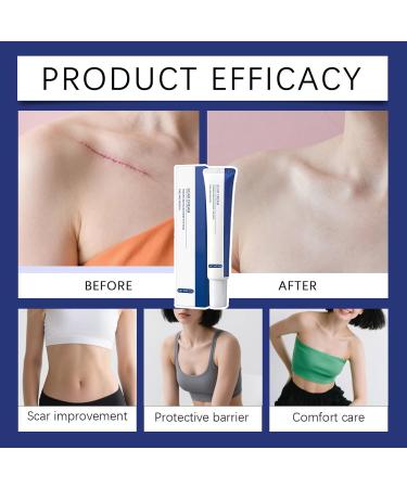 Burn Scar Cream Burn Repair Product - New Soothing Scar Cream - For Men and Women Knees Burns Keloids Wound Recovery - Buy Online on GoSupps.com