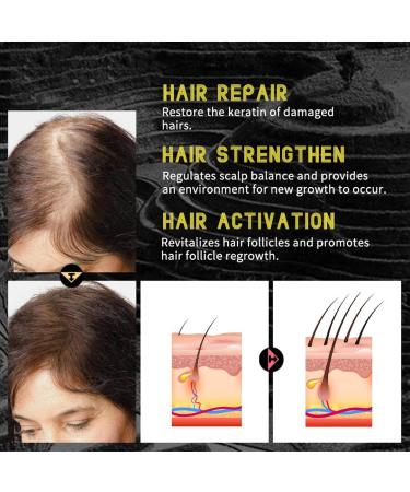 Rice Water Hair Growth Spray with Biotin, Caffeine & Rosemary Oil for Hair Loss - Promotes Effective Regrowth & Thickening - Buy Online on GoSupps.com