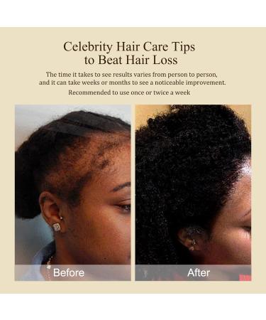 Buy Organic Batana Oil 100% Pure Nourishing Hair Mask for Damaged Hair & Skin | Anti-Hair Loss Treatment | 100 ml - International Shipping Available - Buy Online on GoSupps.com