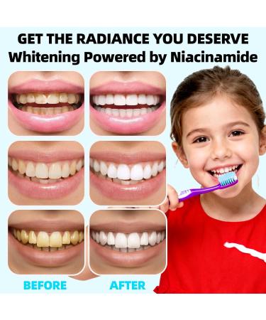 Niacinamide Whitening Toothpaste Effectively Whitens Teeth Protects Tooth Enamel Freshens Breath 24 Hours Fluoride-Free Formula is Suitable for Sensitive Teeth 3.53 Ounce - Buy Online on GoSupps.com