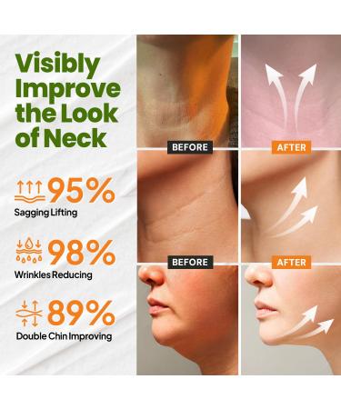 Neck Cream for Tightening Firming: Instant Face Lift Cream - Anti Wrinkle Cream with Retinol Collagen & Hyaluronic Acid - Lifting, Firming & Hydrating for Women- 1.7 FL OZ - Buy Online on GoSupps.com