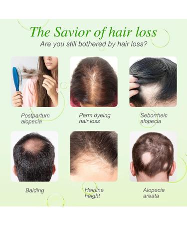 Rice Essential Oil for Hair Growth - 100% Pure Natural Serum for Thin, Damaged Hair - Men & Women - All Hair Types - Buy Online on GoSupps.com