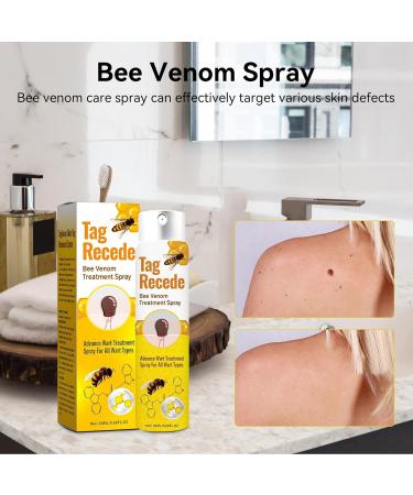  WJnflQN Mole Removal Wart Treatment | Fast-Acting Natural Liquid 20ml Painless Skin Lightening for Feet Hands and Back for Women and Men - Buy Online on GoSupps.com