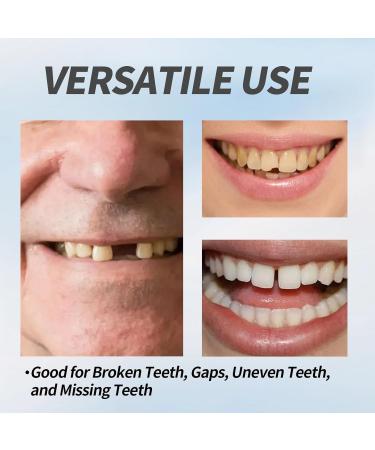 Temporary Tooth Repair Kit - Moldable Denture Beads Tweezers & Tools for DIY Dental Fixes - 50g - Buy Online on GoSupps.com
