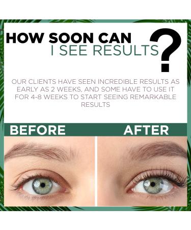 Nuorganic Lash Growth Serum - Vegan & Cruelty-Free | Longer & Thicker Lashes in 30 Days - Buy Online on GoSupps.com