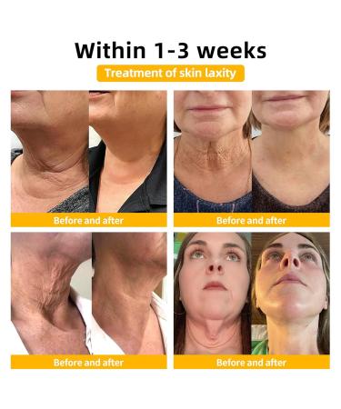 Fivfivgo Ultra Firming & Revitalizing Cream Advanced New Fivfivgo Skin Firming Cream Body Lotion Moisturizer Face Lotion & Body Cream-Renew Skin Firmness for All Skin Types (1Bottle 60ml) 1Bottle 2.02 Fl Oz (Pack of 1) - Buy Online on GoSupps.com