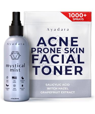 Ayadara Acne Prone Skin Facial Toner | 2% Salicylic Acid Spray for Cystic & Hormonal Acne | Witch Hazel Face Toning Treatment for Women & Men | Acne Eliminating Mist | 1000+ Sprays