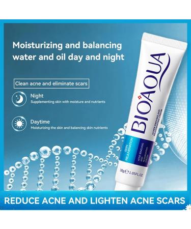 Anti Acne Face Cream Spot Cream for Acne Spot and Acne Treatment for Face and Body Prevent Breakouts and Promote Rapid Recovery Moisturizing Skin Rejuvenation Water-Oil Balance Reduce Redness - Buy Online on GoSupps.com