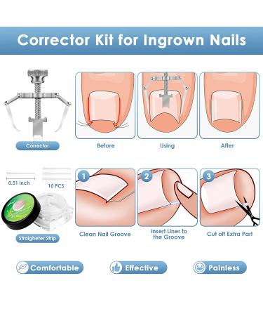 Professional Heavy Duty Toenail Clippers Kit for Thick or Ingrown Nails - Set of 8 | Stainless Steel Pedicure Tool for Elderly Red - Sharp Nail Cutter Set for Ingrown Toenail Treatment - Buy Online on GoSupps.com
