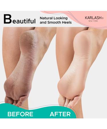 Karlash 2-Sided Nickel Foot File - Mint Callus Trimmer and Remover (1 Pack) - Buy Online on GoSupps.com