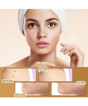 TatttooCover Up Sticker Skin Scar Pimple Sticker Skin Concealing Patches 60 Soft Breathable Latex TatttooCover Up Stickers for Scars and Taattoos Waterproof Skin Tone Inv - Buy Online on GoSupps.com