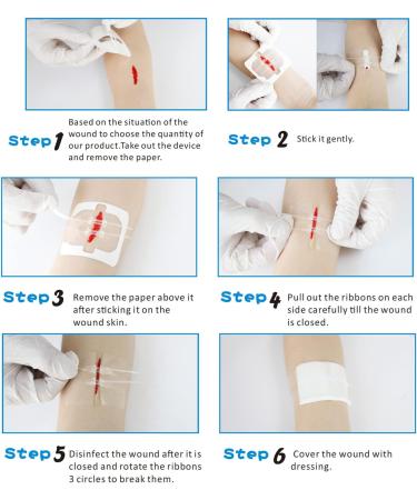Longmed Zipper Painless Zip Sutures for Laceration Repair - 2.36x2.76 Inch, 2 Pieces/Box - Buy Online on GoSupps.com