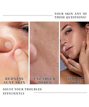 Intensely Hydrating Moisturizer for Face Face Moisturiser Cream for Acne-prone Sensitive Oily Dry Skin Hyaluronic Acid Moisturiser for skin Care with Blue Light Protection Repairing Reduce Redness - Buy Online on GoSupps.com