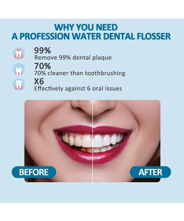 Mocel Cordless Water Dental Flosser - 8 Pressure Levels, Portable DIY Teeth Cleaner, Rechargeable & Waterproof - Ideal for Travel, Braces & Bridges Care - Buy Online on GoSupps.com