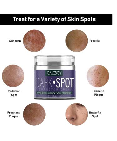 Glutathione Dark Spot Remover for Face & Body with Vit.E, Papaya, Kojic Acid - Fade Cream with Licorice Root & Arbutin - Buy Online on GoSupps.com
