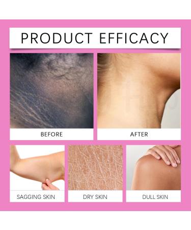 Kojic Underarms Brightening Serum Kojic Whitening Brightening Moisturizing And Revitalizing Skin Mild Ingredients Lightening Serum for intimate parts armpits and intimate parts 30ml (2pc) - Buy Online on GoSupps.com