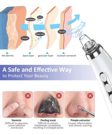 2023 Upgraded Blackhead Pore Vacuum Cleaner - Electric USB Rechargeable Acne & Whitehead Extractor with 5 Probes - Blackhead Remover Kit for Women & Men | JHF21 - Buy Online on GoSupps.com
