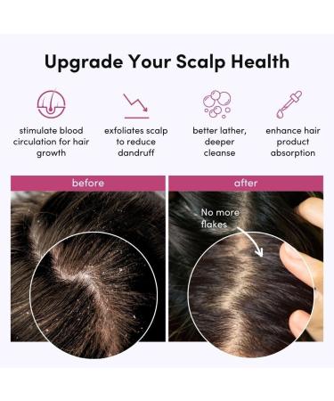 Fancii Silicone Scalp Massage Brush - Hair Growth Shampoo Brush for Wet & Dry Use Head Massage - All Hair Types (Black) - Buy Online on GoSupps.com