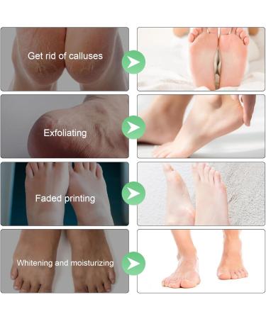 2 Pairs Foot Peeling Mask Exfoliating Foot Mask Exfoliating Peeling Foot Mask for Foot Care Very Dry and Damaged Feet Mask Foot and Callus Peeling Foot Care (Aloe Vera) - Buy Online on GoSupps.com