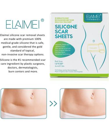 Medical Grade Silicone Gel Scar Removal Tape 1.6x60 - Long Strips for Acne, C-Section, Keloid Surgery - 6-8 Month Supply - 1.5m - Buy Online on GoSupps.com