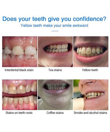 Teeth Whitening Pen Gel 2 PCS - Sensitive Teeth Friendly, Fresh Breath for Travel & Daily Use - Buy Online on GoSupps.com