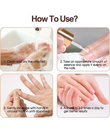 Organic Cuticle Nail Oil 30ml Vitamin B & E Essential Oil Moisturize with Convinient Dropper Design Nail Cuticles Oils Treatment Damaged Dry for Nail Care Repair Growth (Herbal) - Buy Online on GoSupps.com