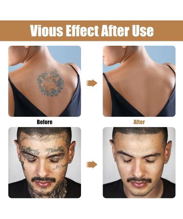 Tattoo Concealer Waterproof Tattoo Cover Up Makeup Two-Tone Skin Concealer for Scars Acne Dark Spots on Body for Legs for Men and Women - Buy Online on GoSupps.com