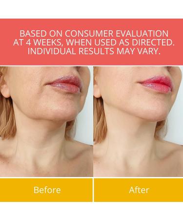 Hibiscus and Honey Firming Cream - Neck & Body Tightening Lotion for Sagging Skin and Double Chin Reduction - Anti Aging Formula - Buy Online on GoSupps.com