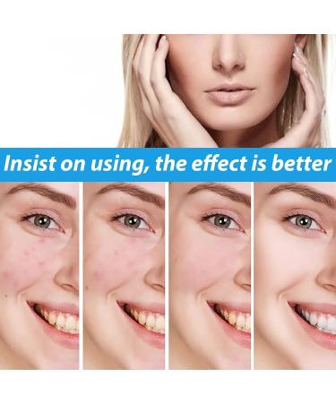 VoaiBekt Crema para Manchas Oscuras en La Cara Cremas para Quitar Manchas de La Cara - Buy Online on GoSupps.com