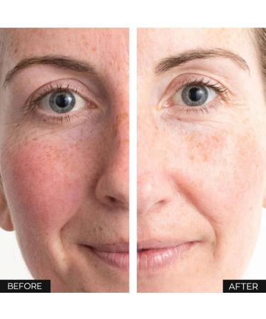 Avonn Anew Protinol Power Serum - Fight 7 Signs of Aging Smooth Skin Minimize Pores & Lines - Fast Results in 7 Days | International Shipping - Buy Online on GoSupps.com