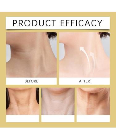 YOENBG AH8 solid neck creampull and lift formula with hexapeptide and double roller massage for crepey skin care moisture firming and skin repair and lift 1 - Buy Online on GoSupps.com